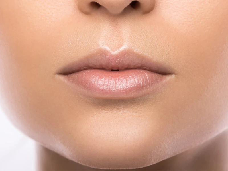 Filler de Labios